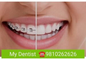Smiling adult wearing ceramic braces at dental clinic