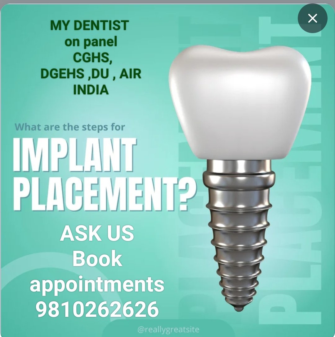 dental implants